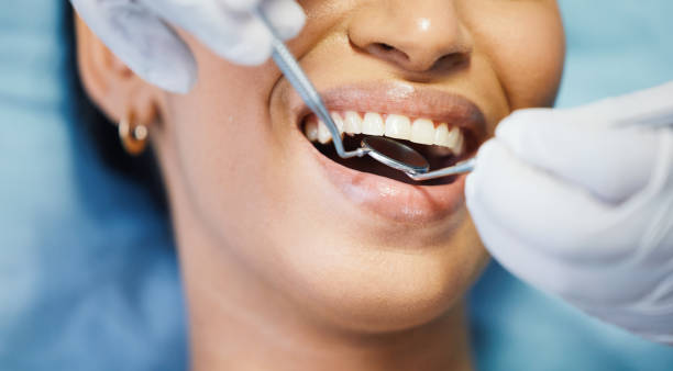 Best Pediatric Emergency Dentist in Big Bear City, CA
